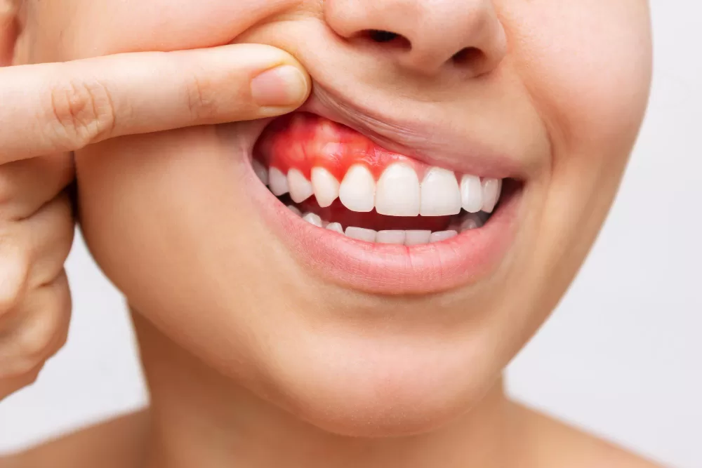 Gum Disease: Prevention, Early Signs, and Treatment Options